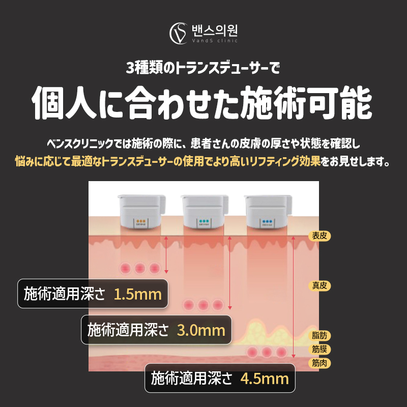 ウルセラピープライム 施術案内画像2
